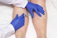 тромбофлебит - 28877 клиенти