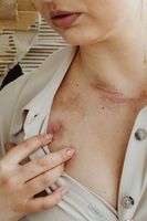 радикулити - 21697 вида