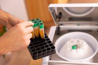 за и против съхранението на стволови клетки - 66469 възможности