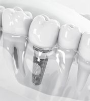 зъболекар Варна - 78053 снимки