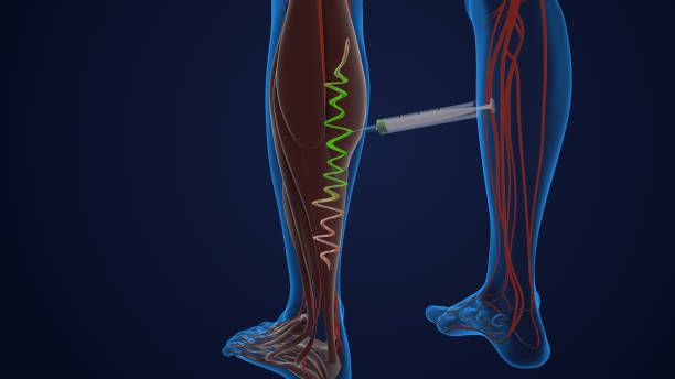 склеротерапия - 12569 клиенти | spectroima.com склеротерапия - 45978 клиенти