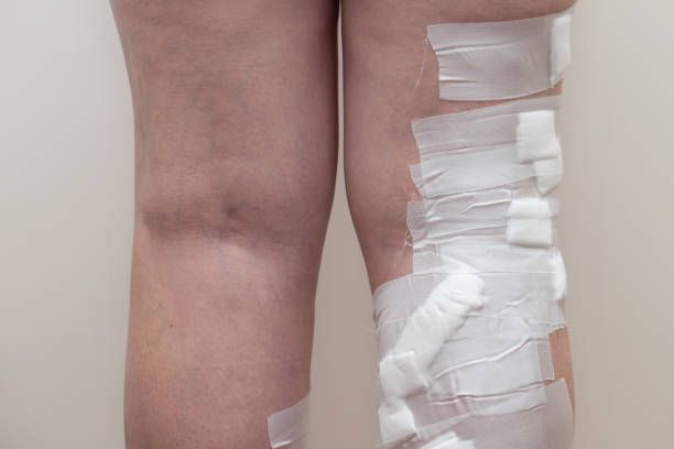 склеротерапия - 2007 цени склеротерапия - 95985 цени